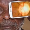 Com este app incrível, um médico poderá examinar seus olhos só com um smartphone