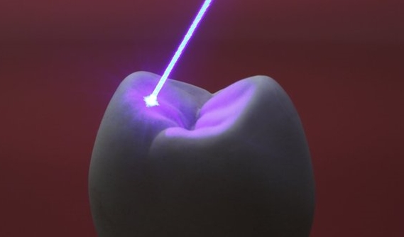 Laser - dente (Fonte: SPL)