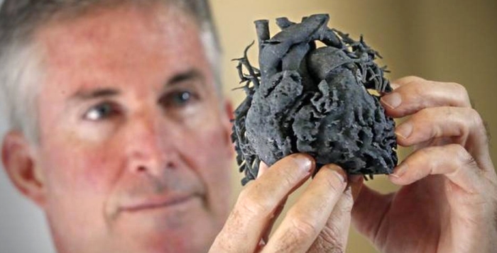Mais um caso: réplica de coração feita em impressora 3D ajuda a salvar menina de quatro anos