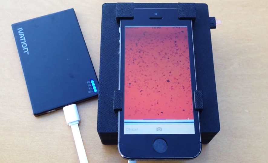 Pesquisadores desenvolvem acessório para iPhone que detecta parasitas no sangue