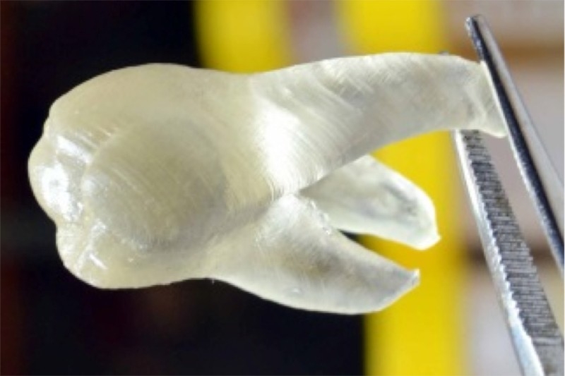 Não falta (quase) nada: pesquisadores usam impressora 3D para criar dente imune a bactérias
