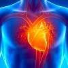 Cientistas estudam técnica que permitirá transplante de coração com doador incompatível