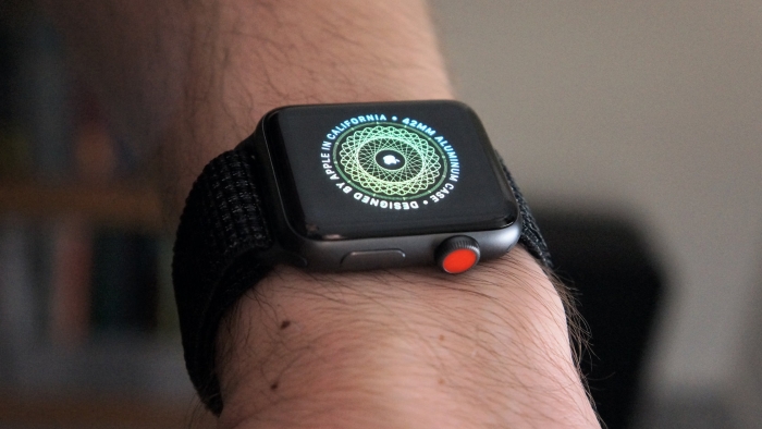 Apple Watch pode detectar diabetes com 85% de precisão