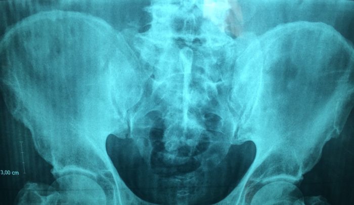 Google quase publicou 100 mil raios X com informações de pacientes