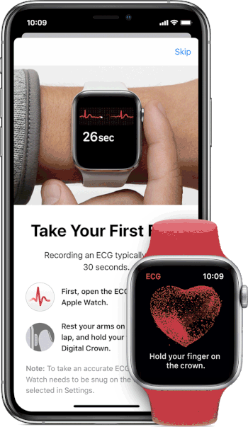 Apple Watch - Eletrocardiograma (ECG)