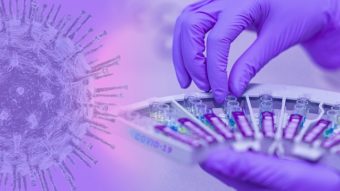 PCR, Antígeno, IgG e IgM: entenda os testes de coronavírus