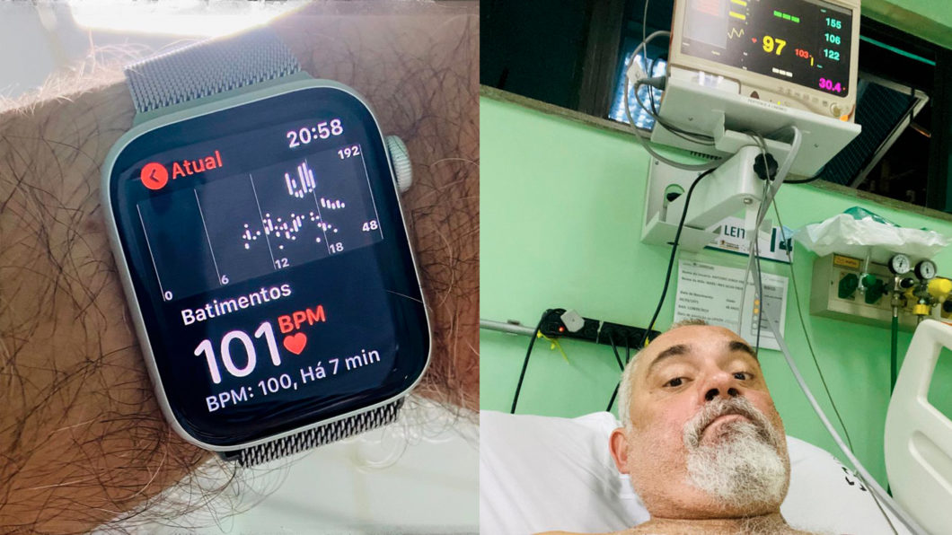 Relógios inteligentes que detectam AFib – principais opções