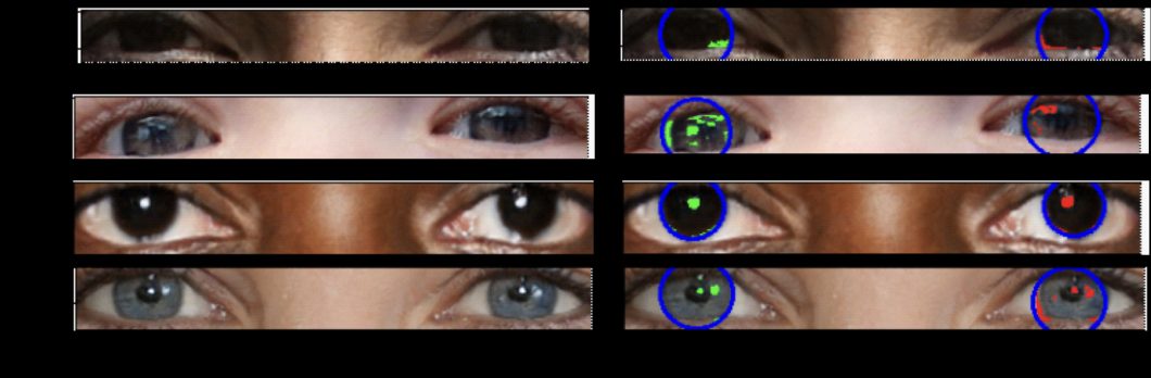 Análise de deepfakes mostra distribuições de luz diferentes nos dois olhos