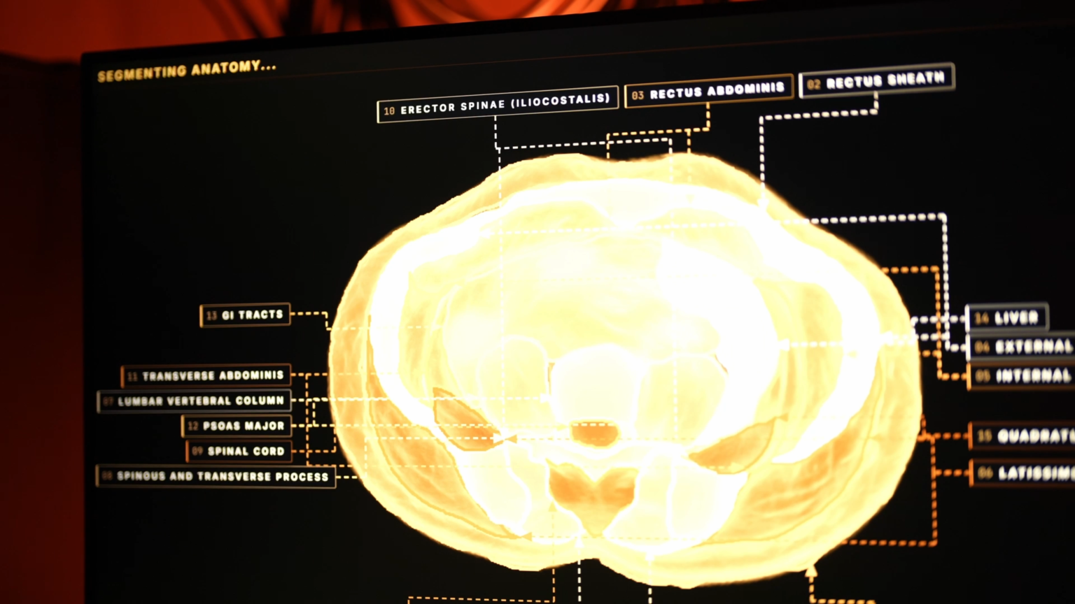Midjourney has introduced an AI-powered body scanning feature Videoframe 60907 1536x864